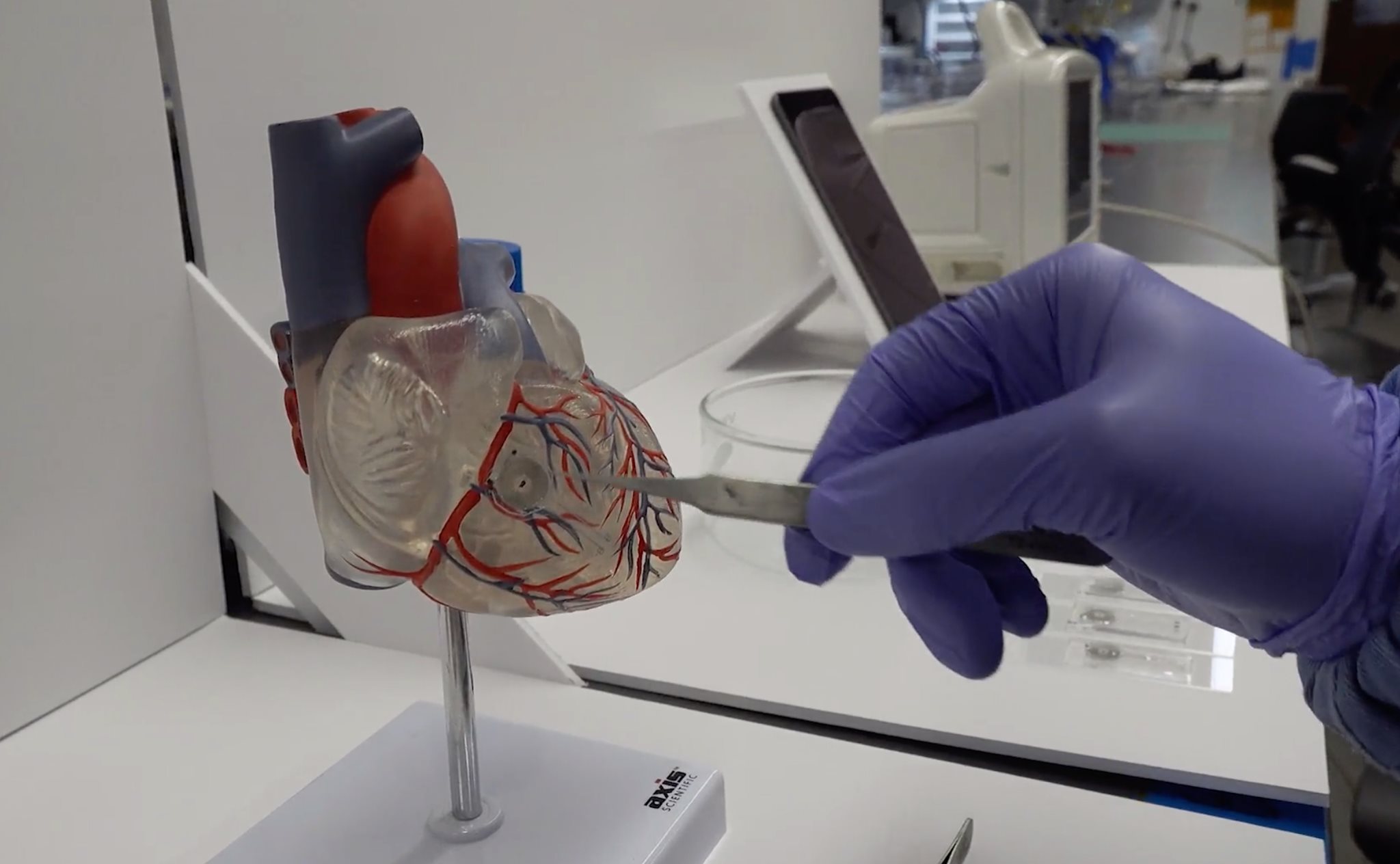 A new kind of pacemaker is... - Under-Told Stories Project