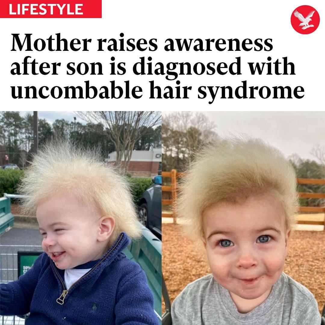 The Independent - 🔴 A mother is raising awareness about her one-year ...