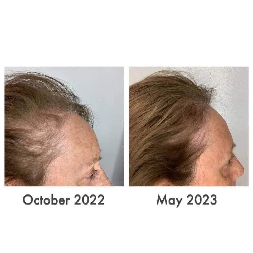 does klow help with hair growth Which is better for loss, or Glow? Buy HEAL | Research Selection:90 Vegetarian Capsules تونر يعيد الاشراق