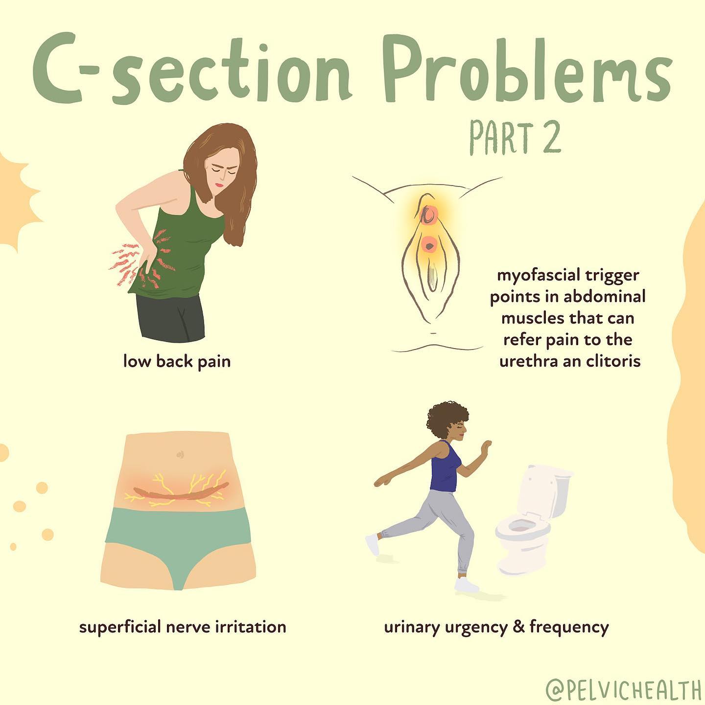 Pelvic Health and Rehabilitation Center - Whenever an incision has been ...