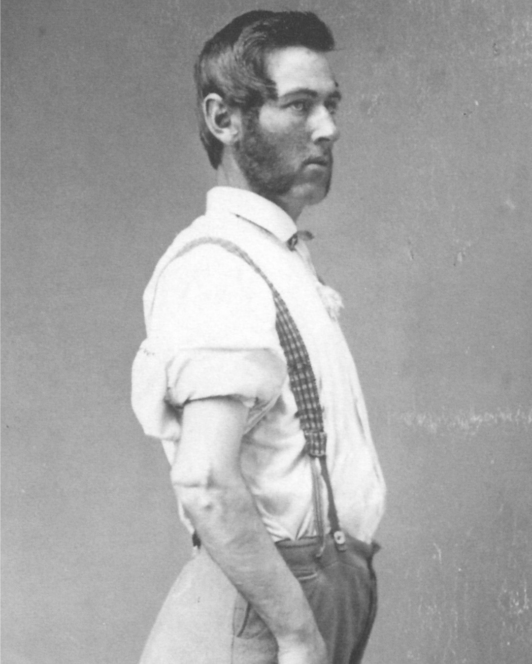National Museum of Civil War Medicine - William T. Riley Private, 86th ...