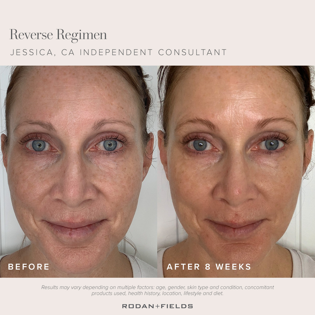 Rodan - Results that speak for themselves. Swap dark spots +