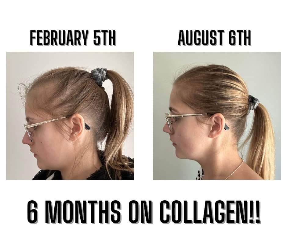 klow hair growth Peptides for Hair: Guide to (2026) klow hair growth 3 years