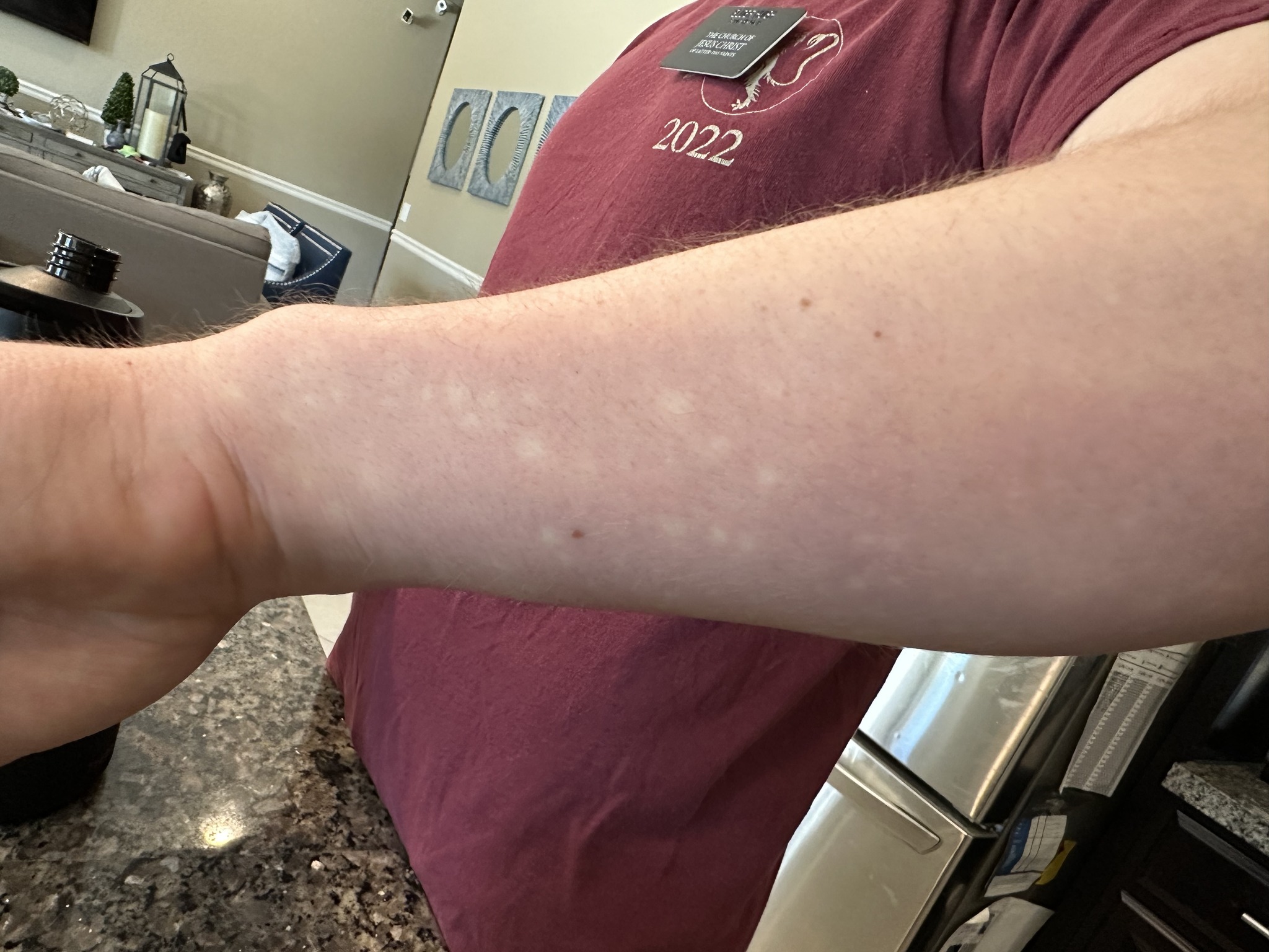 My husband has chronic Lyme disease and chronic pain--even after 6 years of Lyme treatment (mostly with naturals/homeopathy, diet, etc.). He is also +- for MTHFR A1298C. He is also ++ for