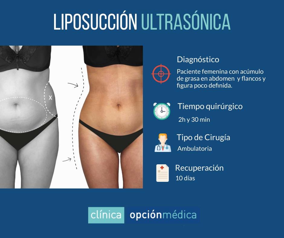 lipo c efectos secundarios Nutrex pre workout Back Her 60 caps La Liposuccin Ultrasnica es un