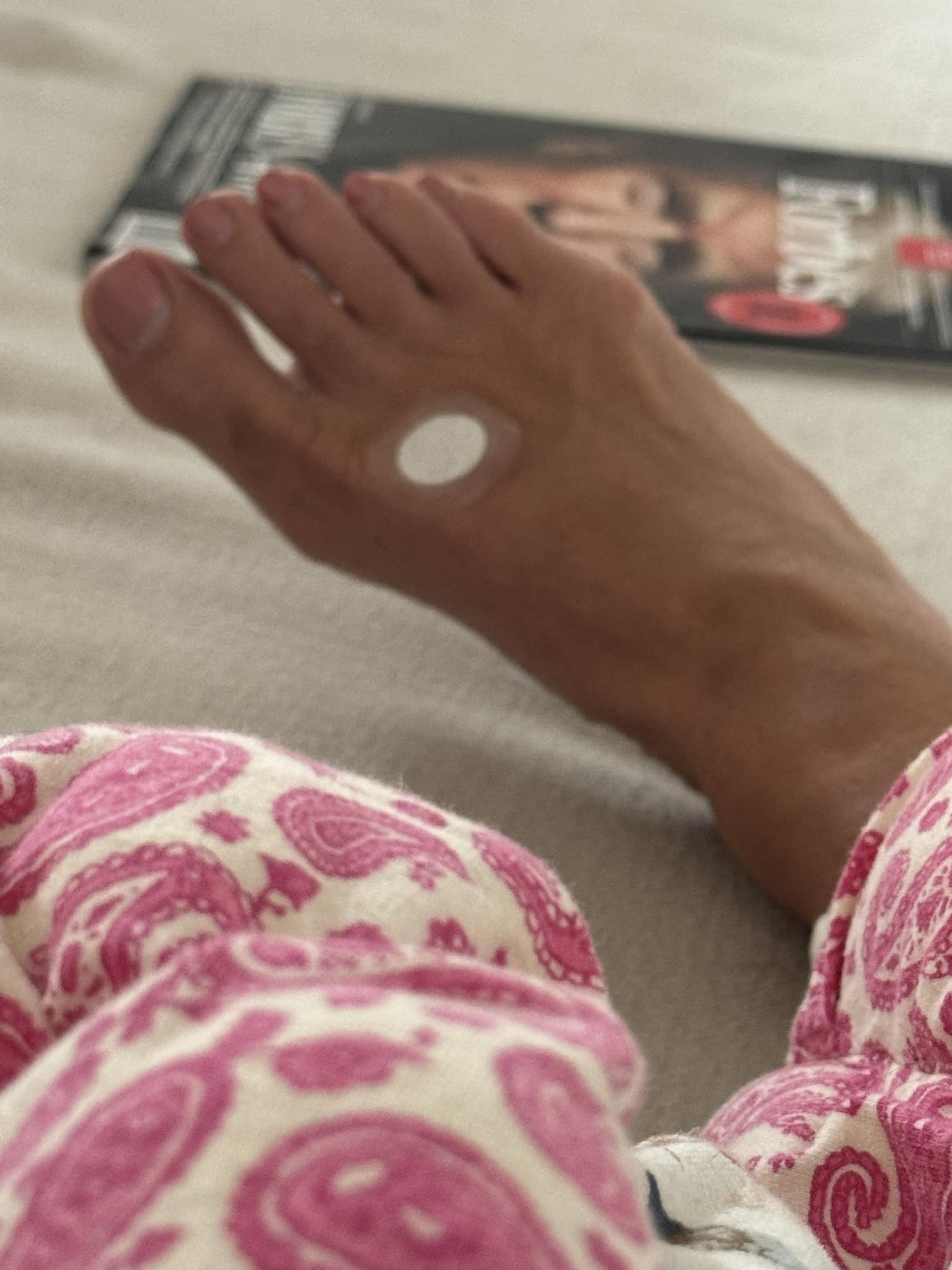 glutathione on feet Has anyone tried skin patches, IM, or IV therapy for detox and inflammation? Phase 1 Estrogen Ratios Endosomes Quantity:3 L