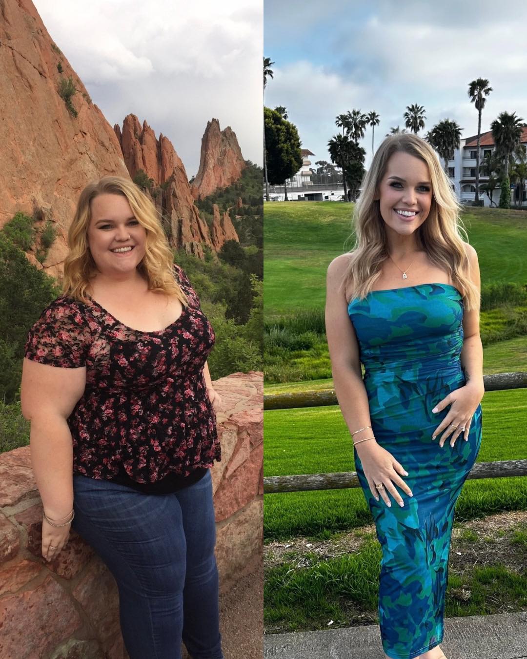 can you use glp 1 after gastric sleeve GLP-1 Surgery: Safety & Biomarker Context  PlexusDx GLP1 medication helps eliminate food