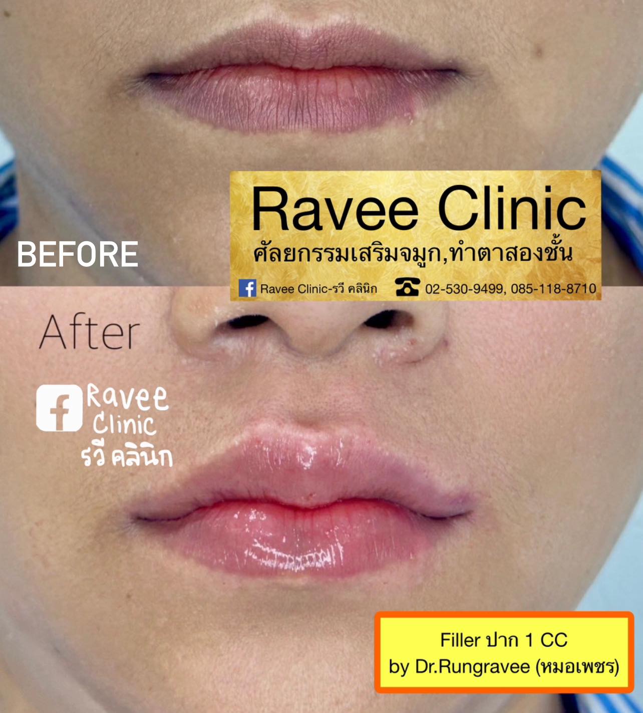 Ravee Clinic - รวี คลินิก | Bangkok