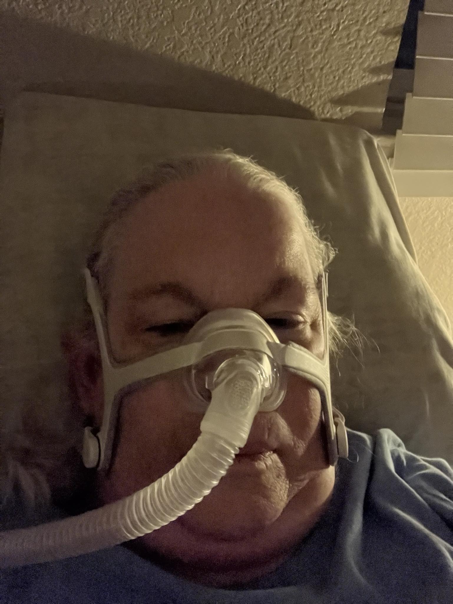 1st night with c pap nd lips swollen First ResMed 11 CPAP machine 2 Size:60ML