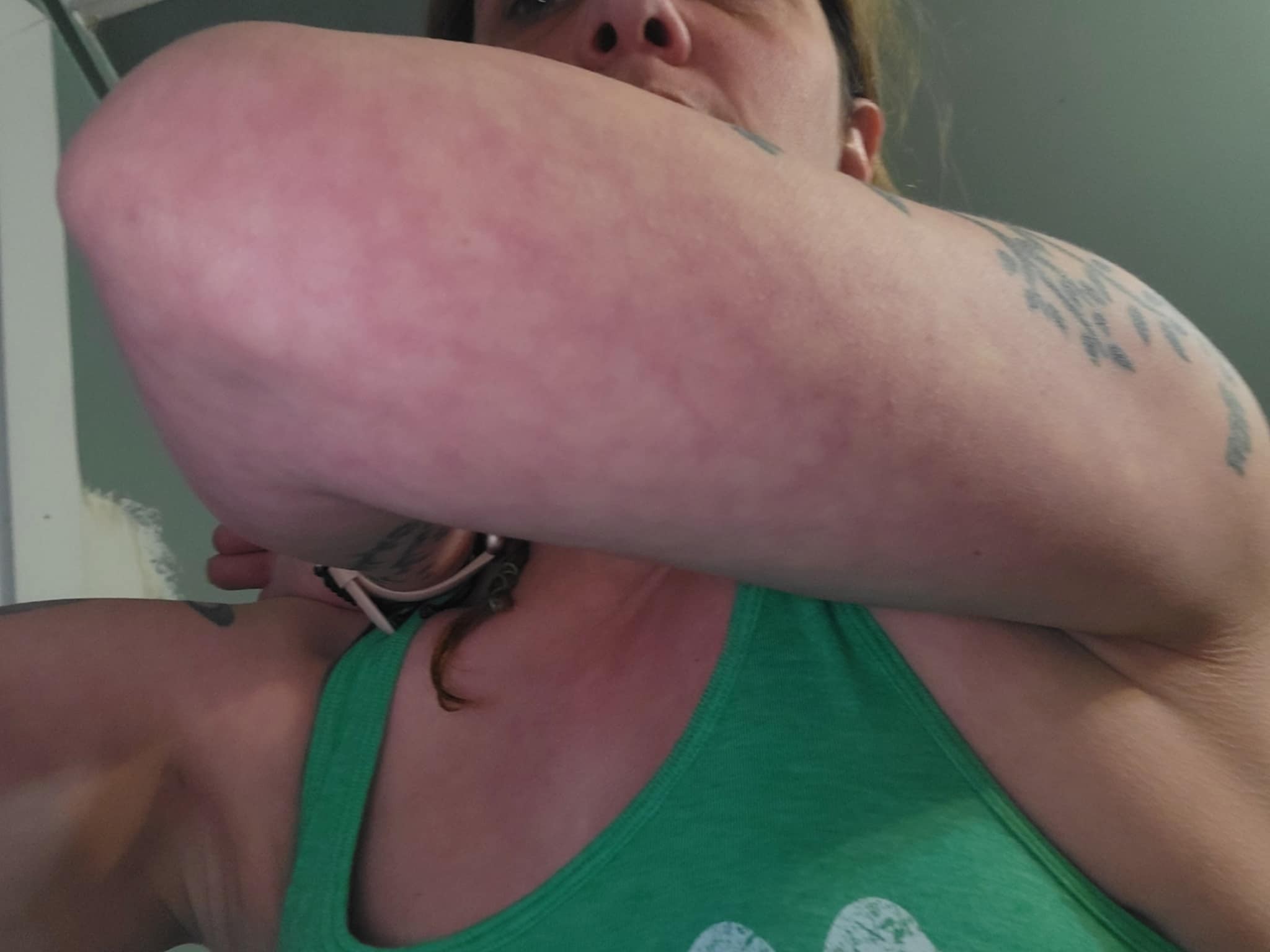 glutathione ehlers danlos Is livedo reticularis a symptom of Syndrome? Adult Supplements Perricone MD Essential Fx Size:1.8 oz.