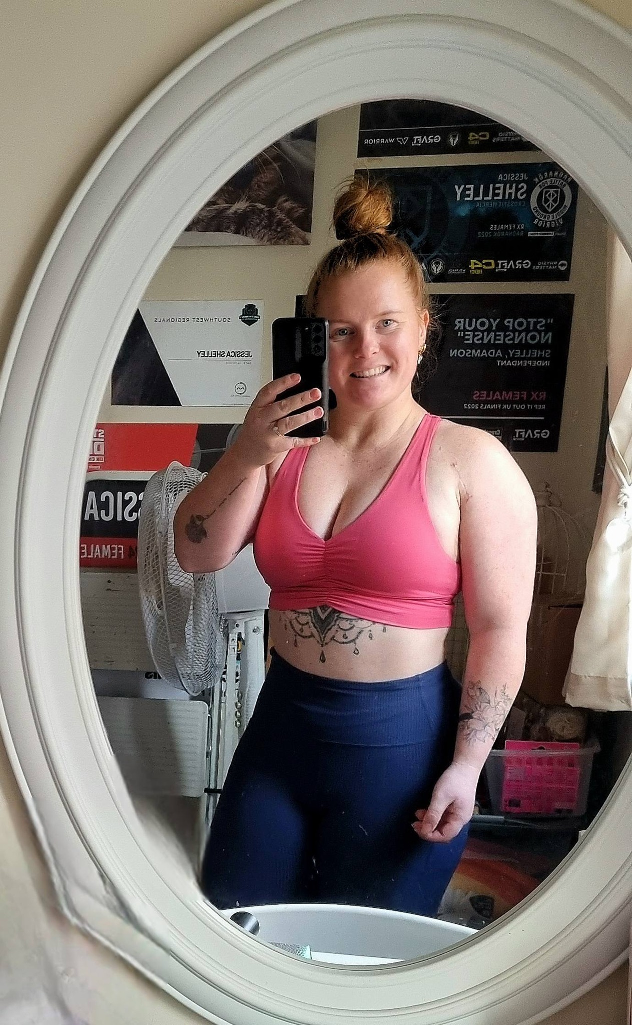 Progress after bicep tenodesis surgery at 31 days