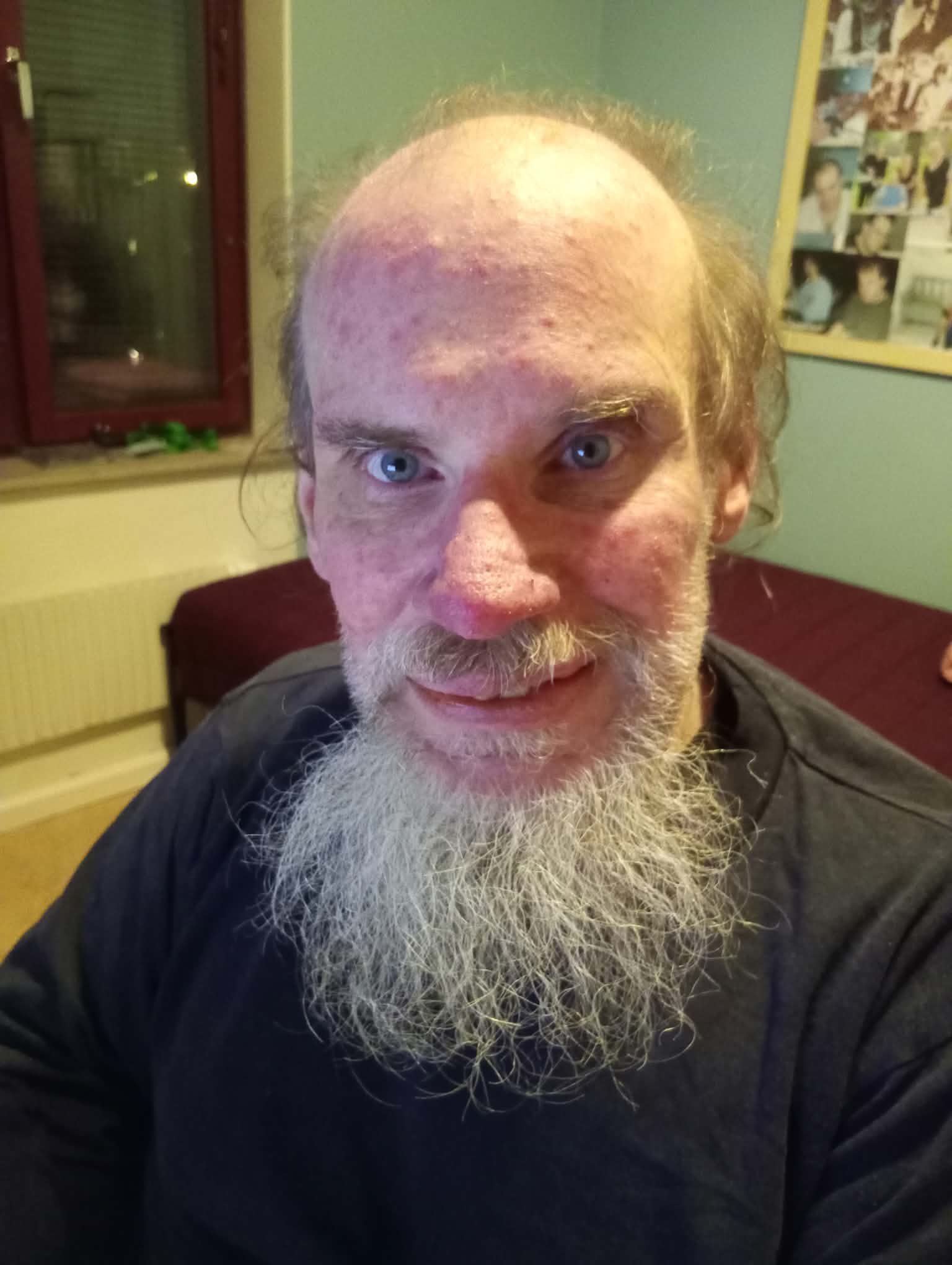 Mattias - Ung man, med 54-årings skägg!?! Alternativt uttryckt - jag ...