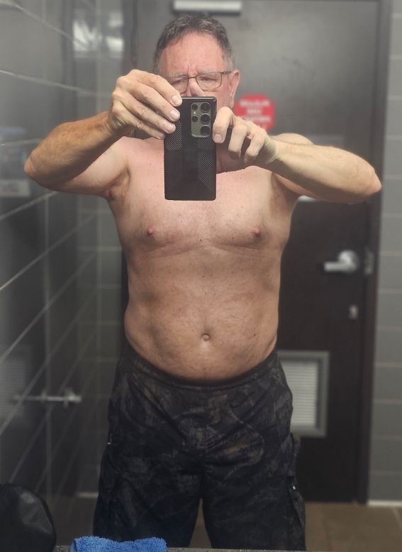 Tirzepatide weight loss transformation