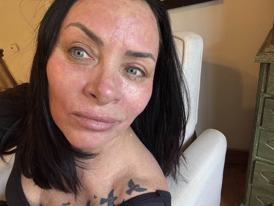 Debra Brill - Trying to keep 57 fresh lol ! Micro needling... | Facebook