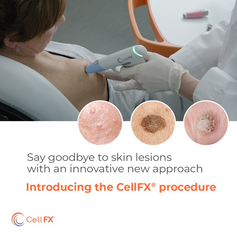 PHDermatology - Introducing the CellFx procedure! Do you... | Facebook