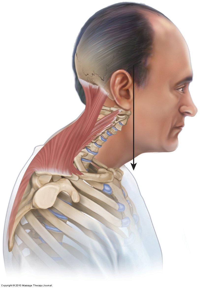 Category forward head posture (FHP): A multidisciplinary approach to ...