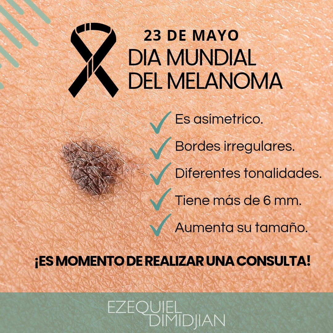 Dr - En el DIA MUNDIAL DEL MELANOMA queremos concientizarte sobre la ...