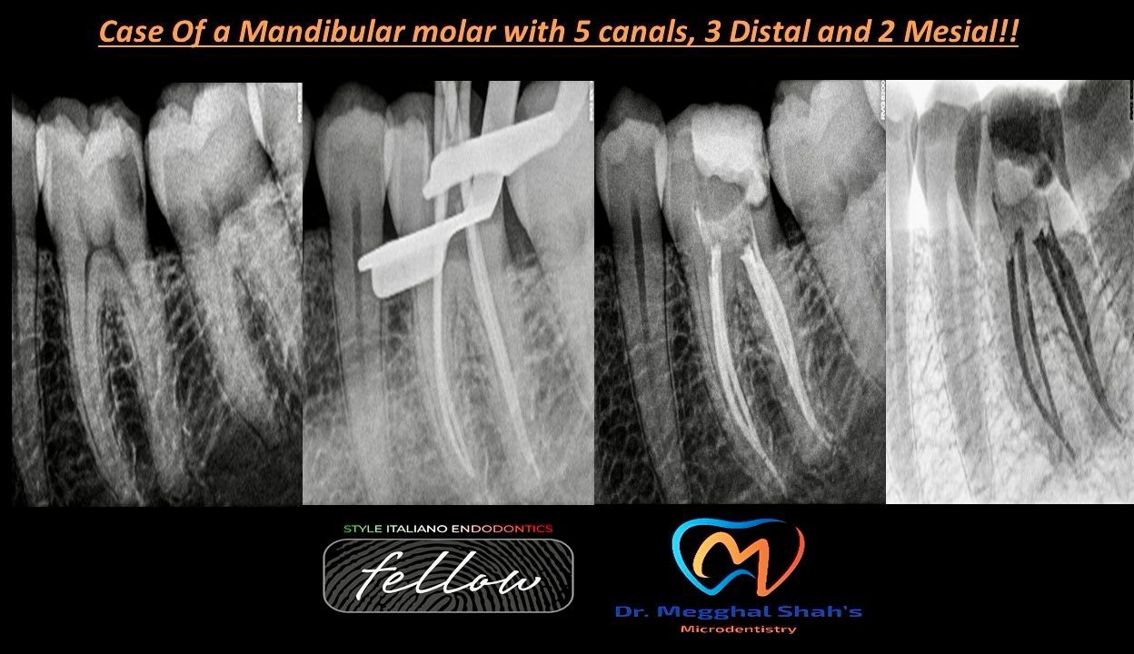 Style Italiano Endodontics | 