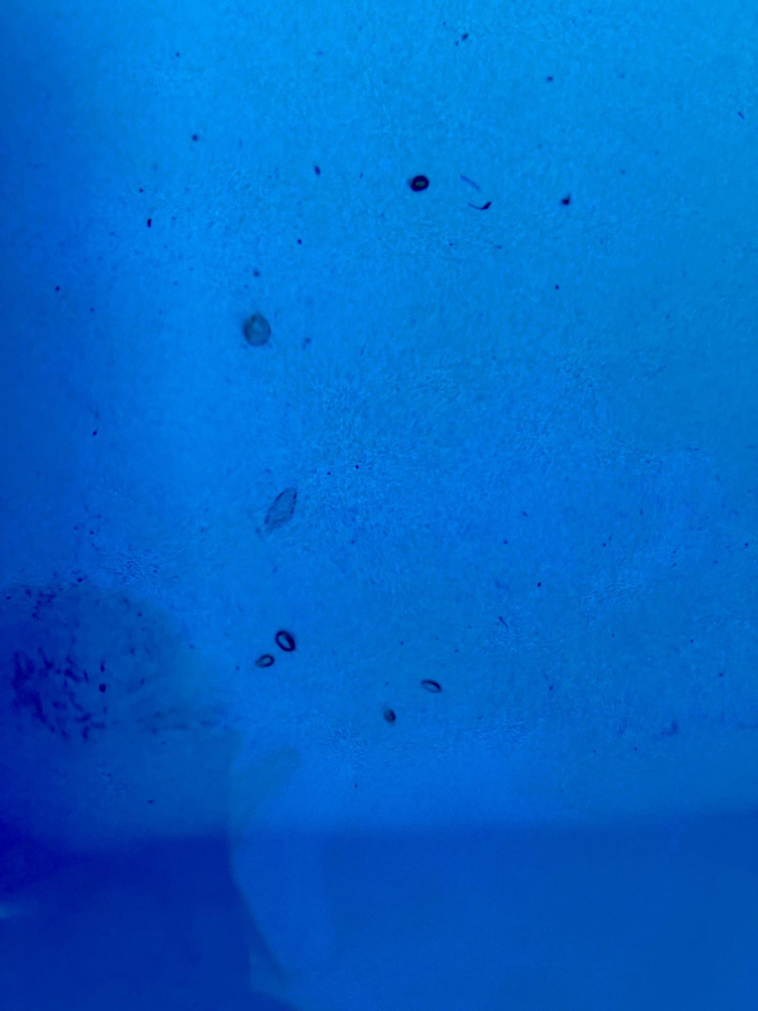 Above Ground Swimming Pools Group | I have dark blue spots in the ...