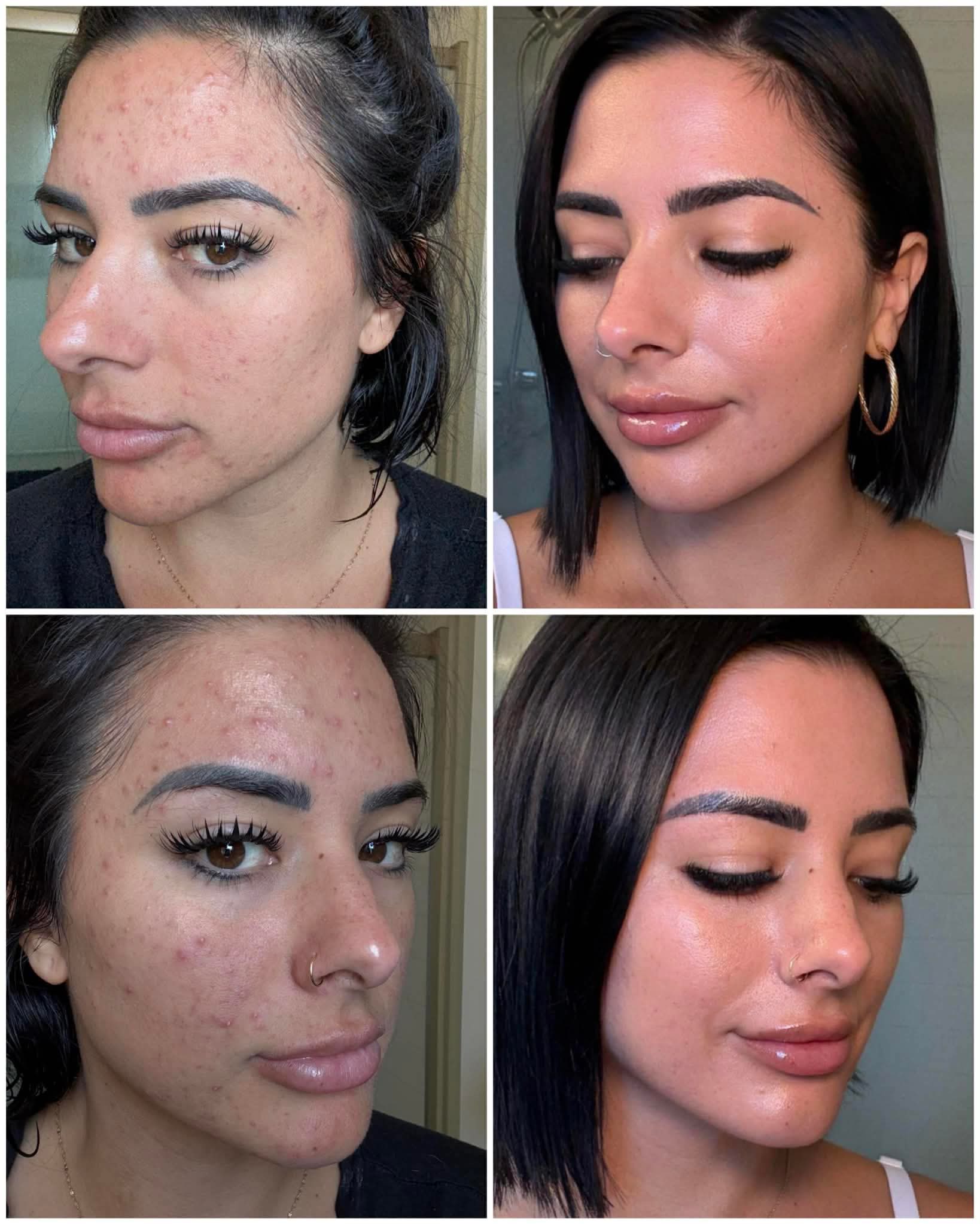 https://elliemd.com/product/ghk_cu?bp=justmariechristine Smurf juice. Pretty peptide. Fountain of youth. Properly known as GHKcu. LET'S talk! All the beauty/health guru's are screaming about the GHKcu copper peptides. Since I have access to it via