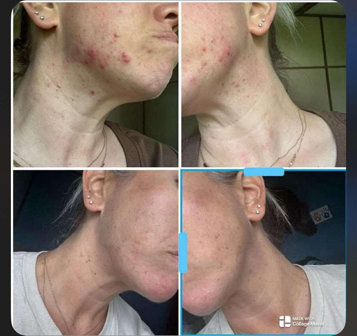 https://elliemd.com/product/ghk_cu?bp=justmariechristine Smurf juice. Pretty peptide. Fountain of youth. Properly known as GHKcu. LET'S talk! All the beauty/health guru's are screaming about the GHKcu copper peptides. Since I have access to it via