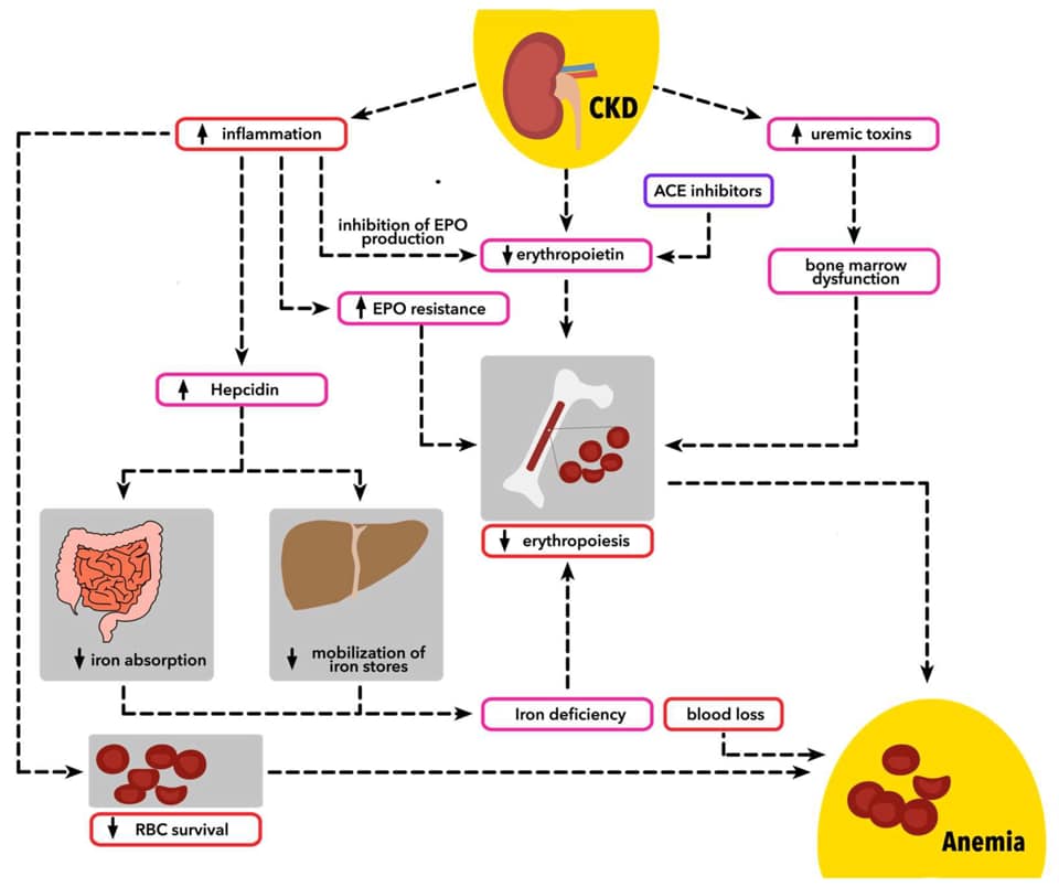 สรุป Pathophysio ⚱️Anemia⚱️ จาก... - Nakorn - Core Physiology | Facebook