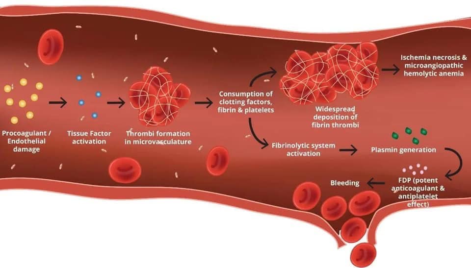 สรุป Pathophysio ⚱️Anemia⚱️ จาก... - Nakorn - Core Physiology | Facebook