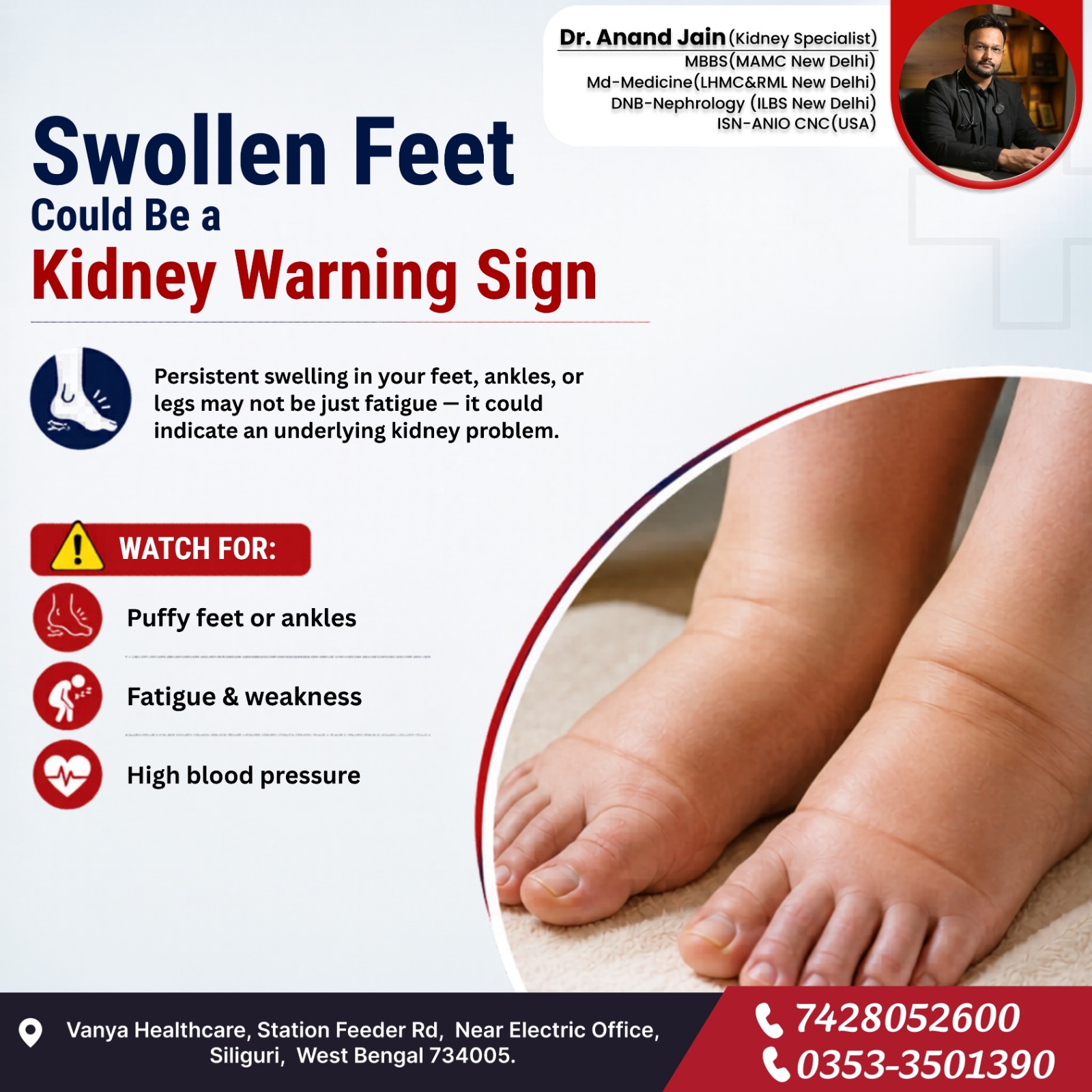 Swollen feet and ankles should never be ignored. Persistent puffiness in the feet, fatigue, weakness, or high blood pressure may sometimes point toward underlying kidney issues. Early diagnosis can help prevent serious