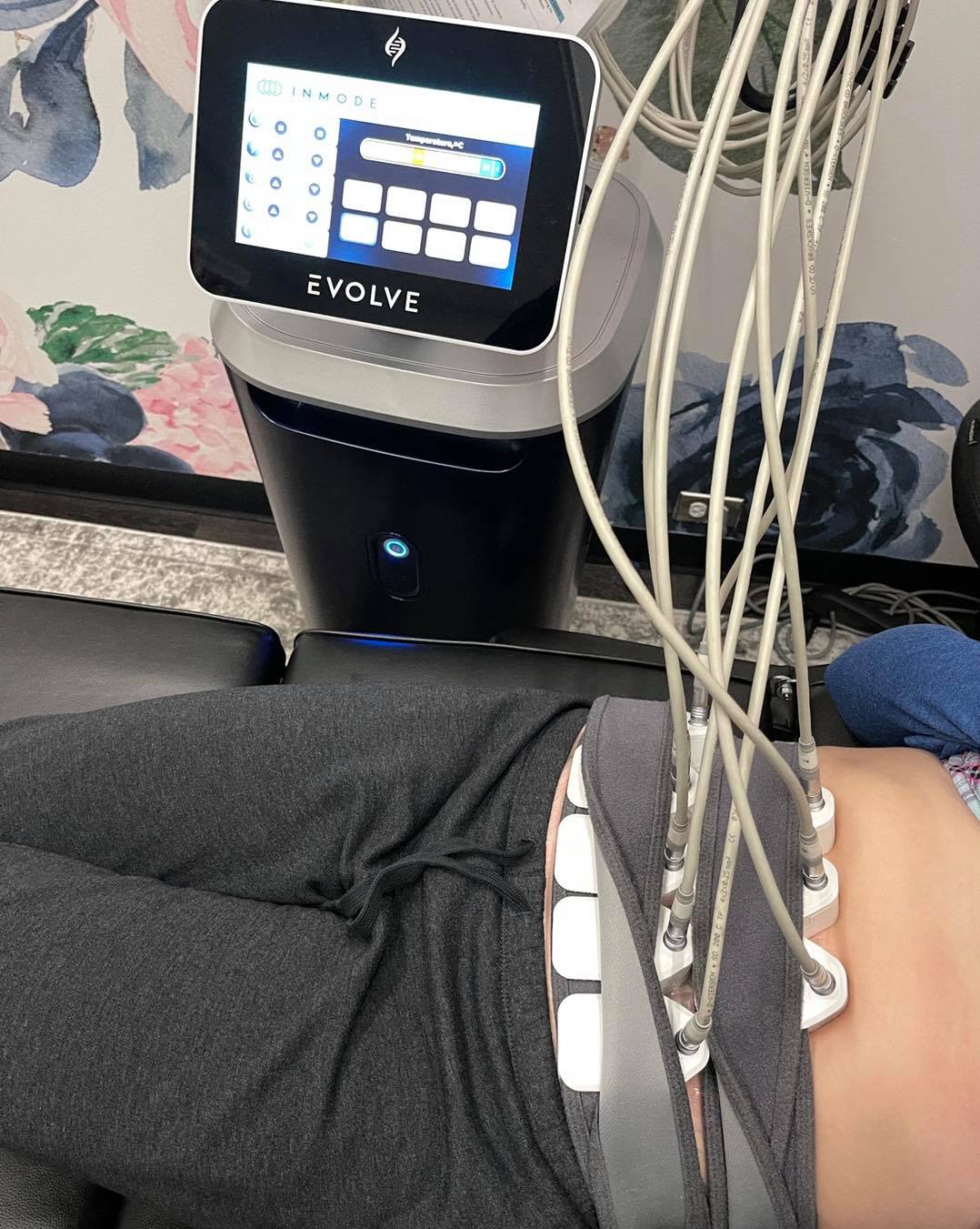 With our Evolve Machine we can... - Aesthetics at Southern
