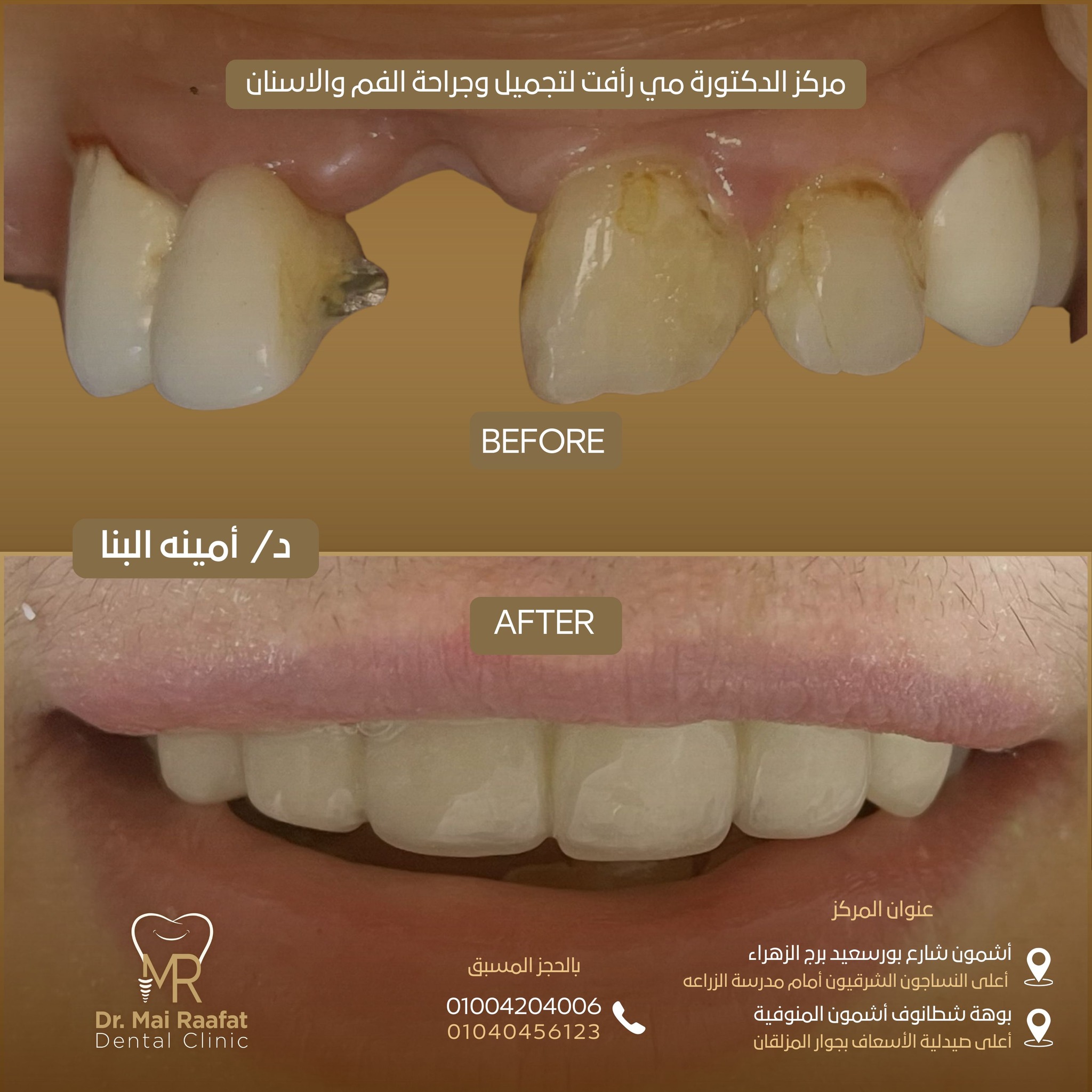 Dr. Mai Rafaat Dental Clinic | Ashmun