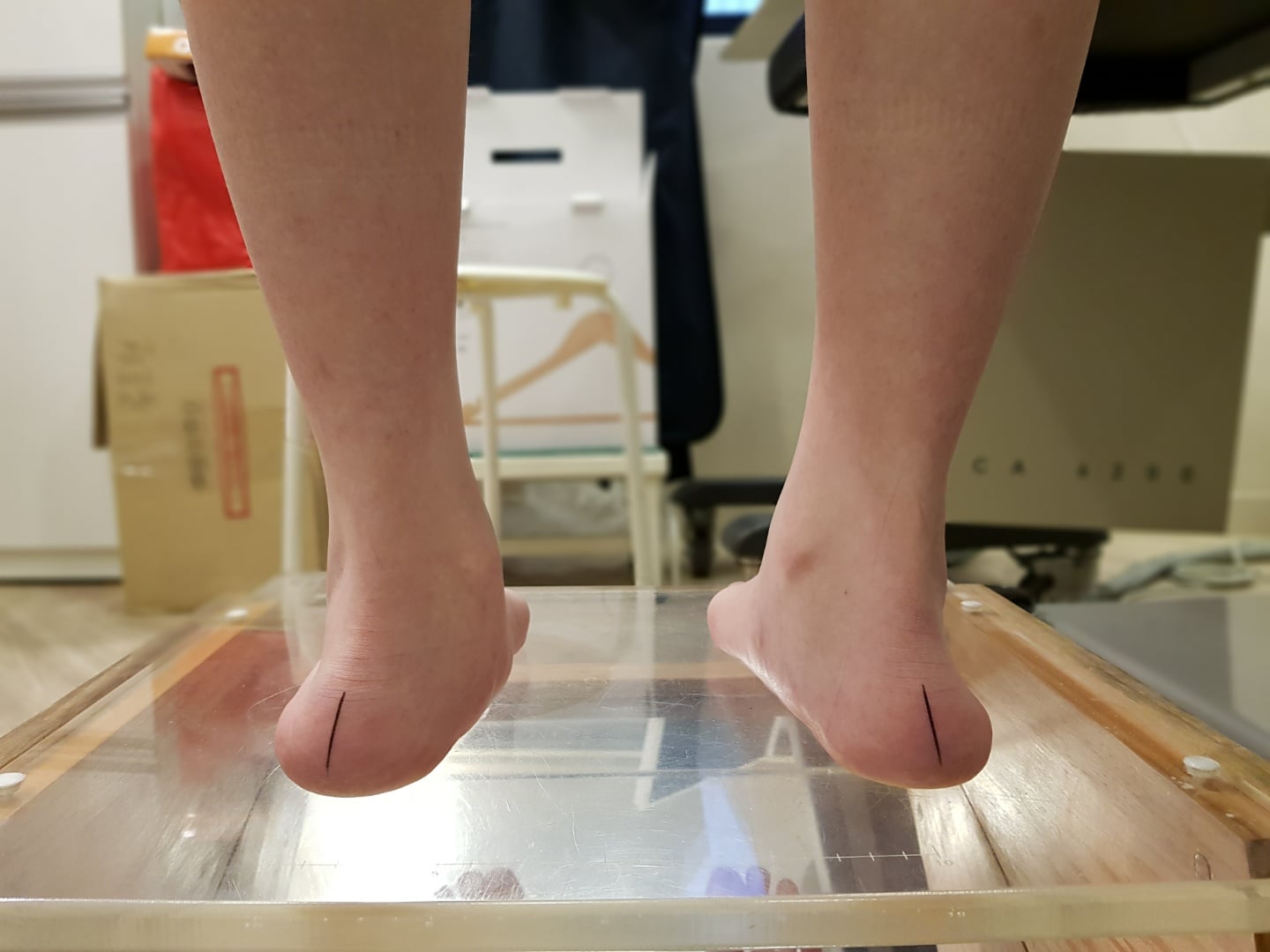 바이오메카닉스 - [ 세상 foot foot한 이야기 ] . . 바이오메카닉스가 만난 20세 여성입니다.... | Facebook