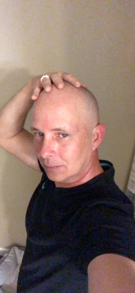 no hair, don't care 🧑‍🦲