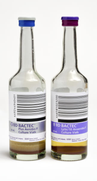 Lab technicians and medical information | Why BACTEC system is better ...