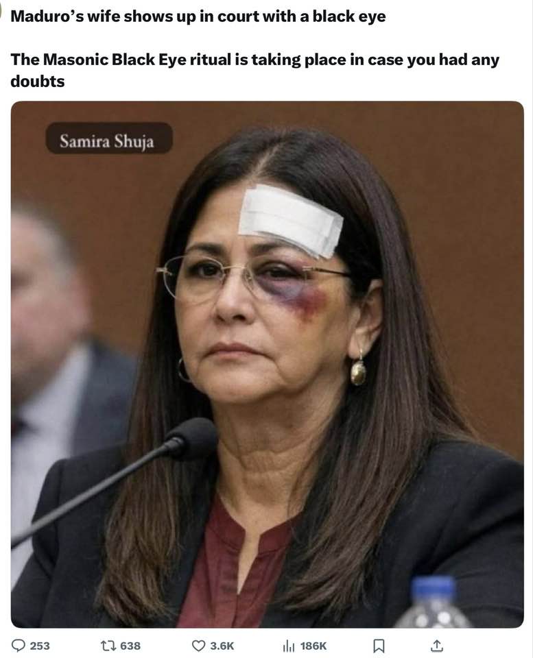 Sandra Boulton - BLACK EYE EXPOSURE. What is the Black Eye... | Facebook