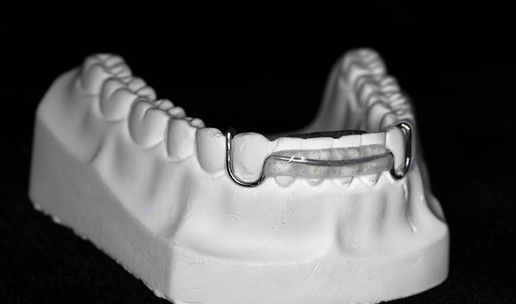 El Spring Aligner🦷 es un tipo de... - Luis Donaldo Palacios