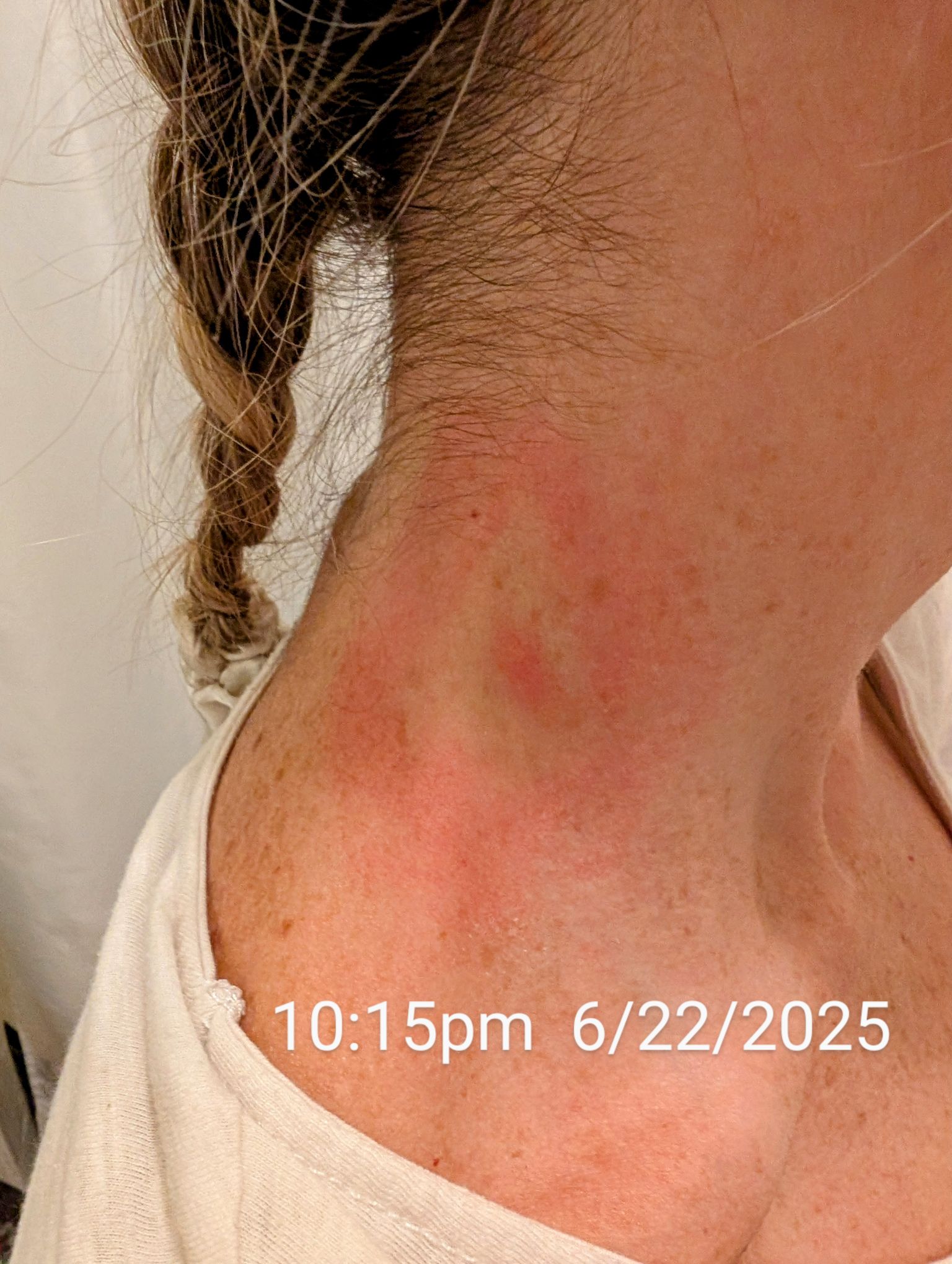 PA - 🕷️ Pennsylvania Weekly Tick Report 🕷️ Heads up, PA! Blacklegged ...
