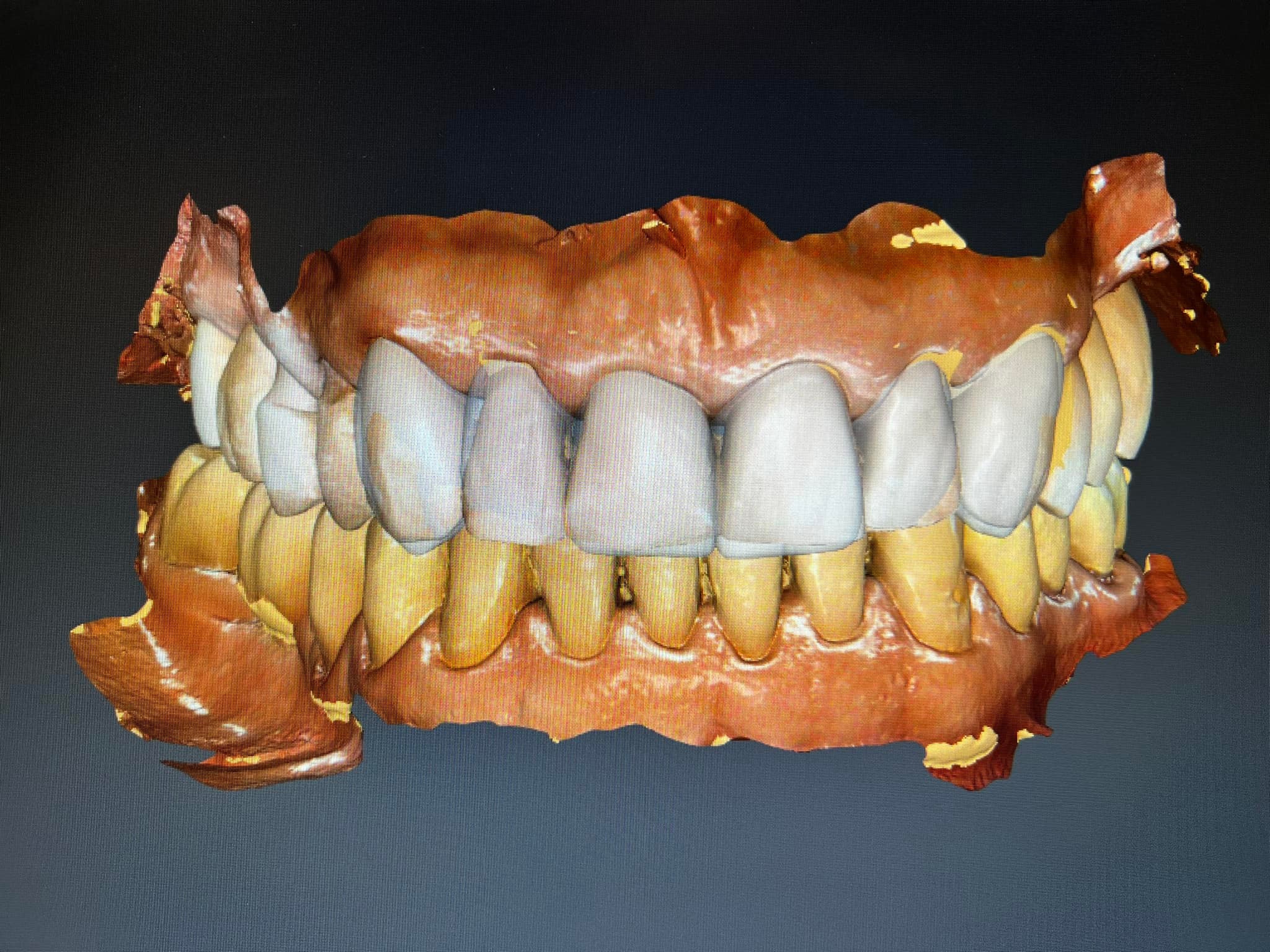 nLab 4.2 Software Wth Lcence SRONA CEREC | eBay