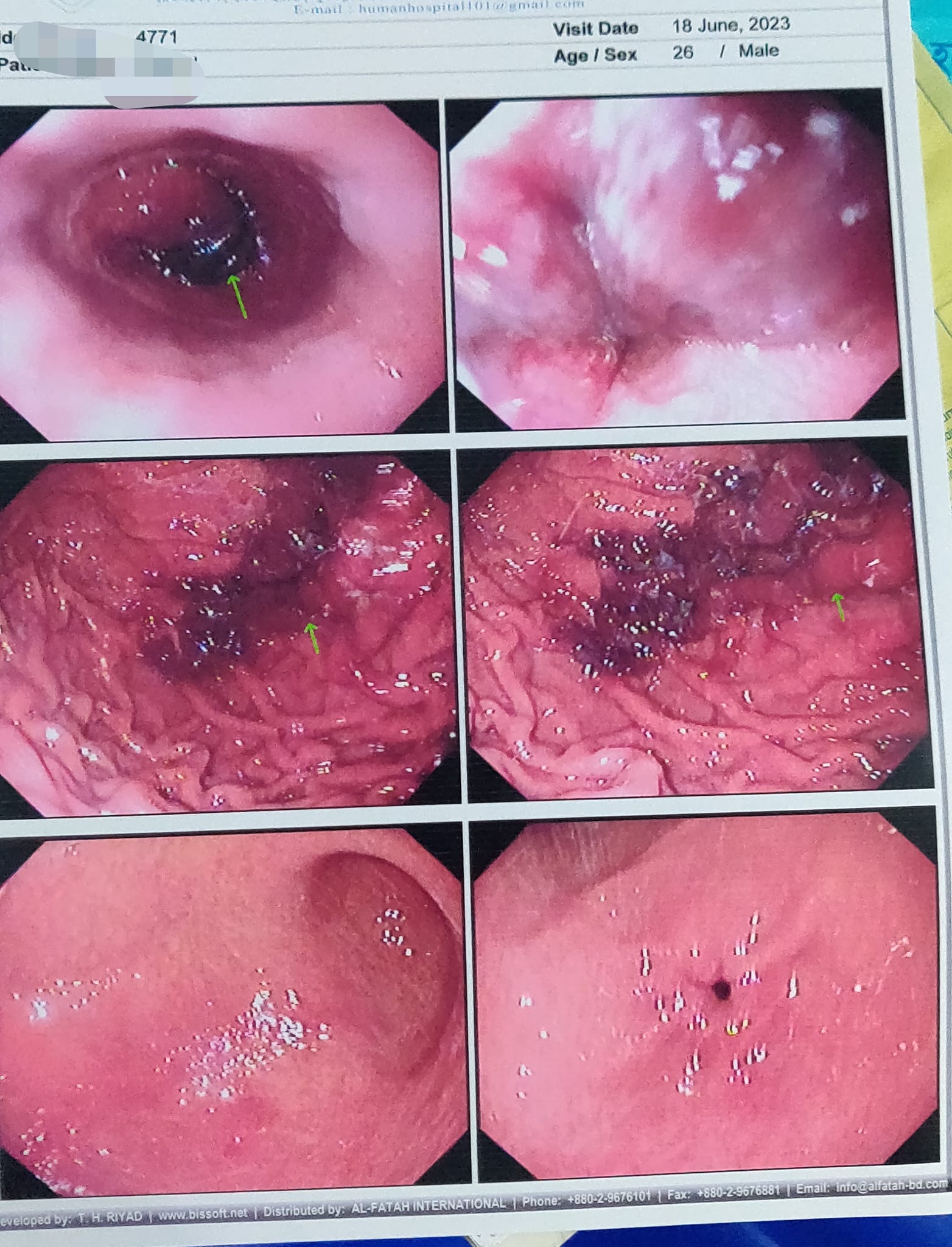 Porn Picture