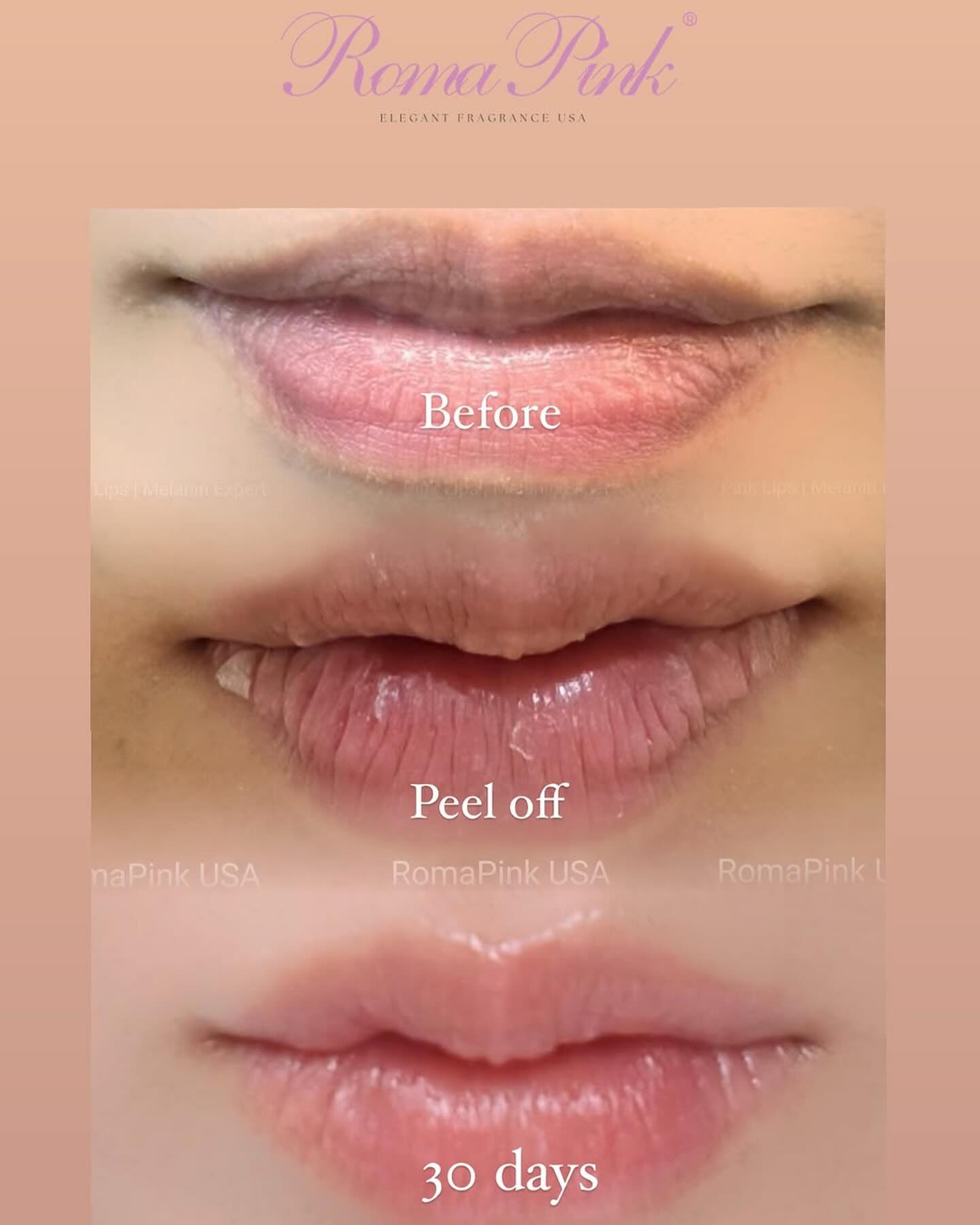 💗𝑹𝒐𝒎𝒂𝑷𝒊𝒏𝒌 𝑼𝑺𝑨 Roma Pink Lip💗 只需十五分鐘！由黑轉粉