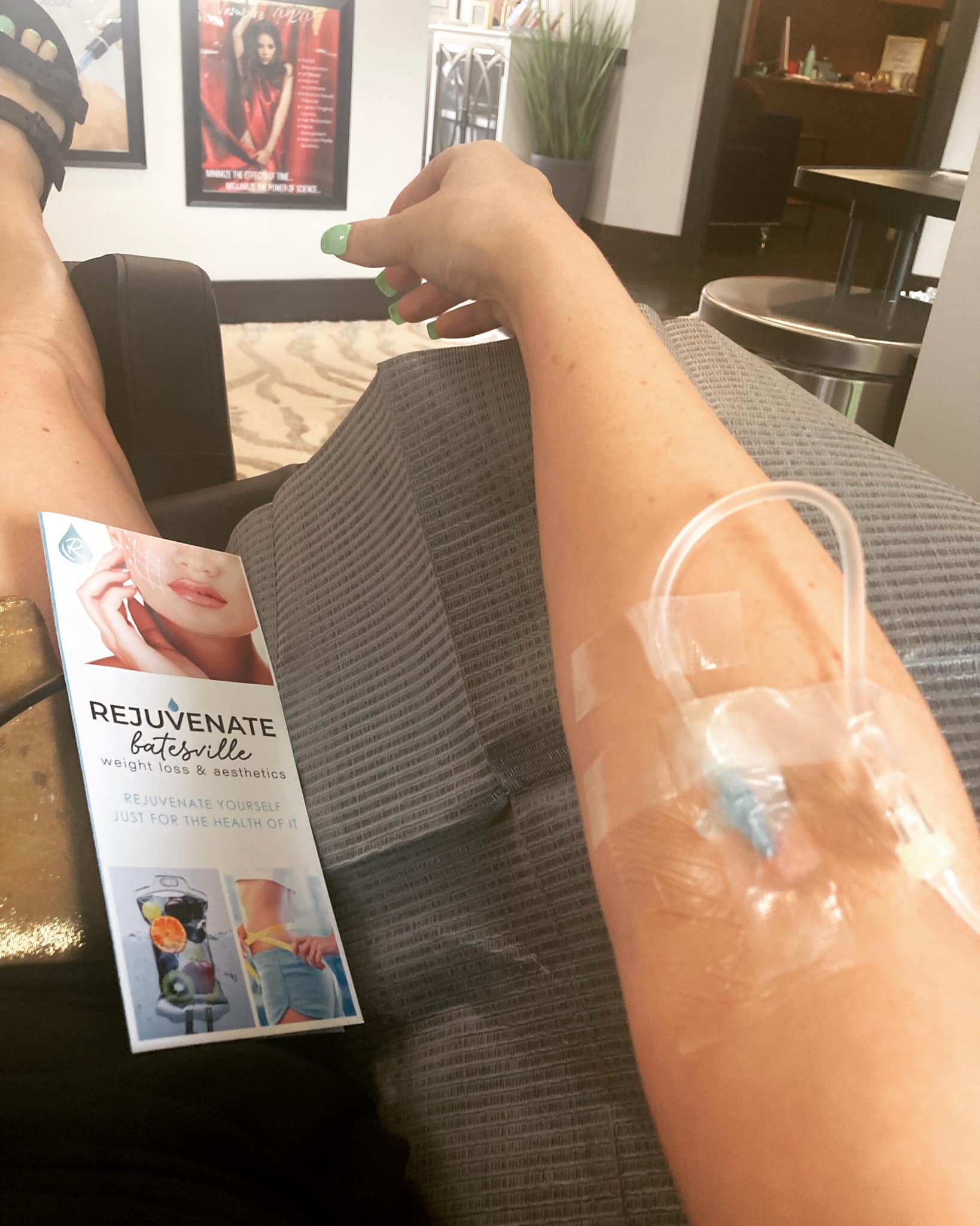 b12 injection leg Has anyone tried IV vitamin C and therapy? Vitamin B12 Injection vs