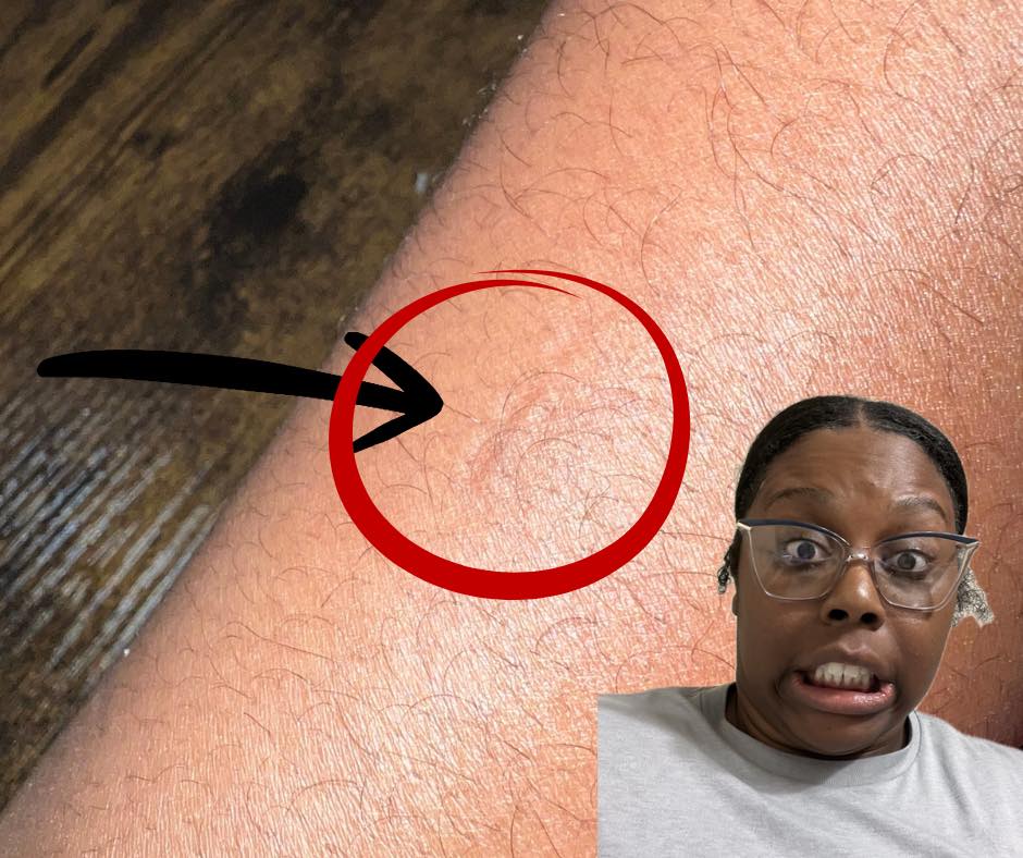 Does this look like a bite mark to yall ? My son isn't a bitter he