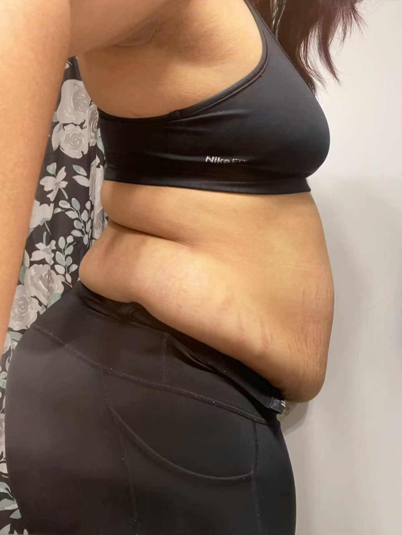 still feeling hungry on retatrutide So hungry! : r/Retatrutide Why am I losing weight