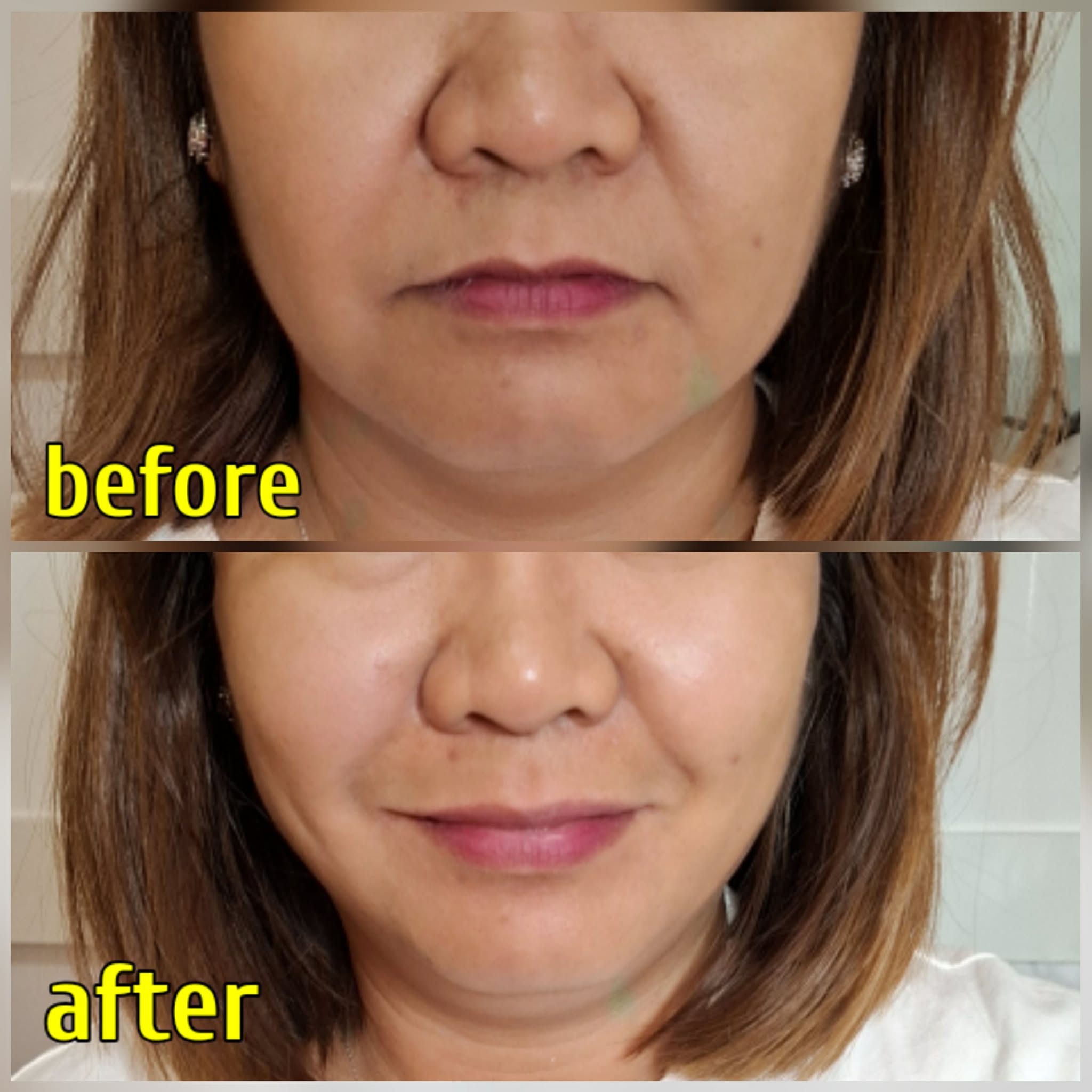 klow peptide before after is a POWERFUL formulation that combines four of the most clinically recognized compounds; GHK-Cu, BPC-157, TB-500, and KPV. While these individual peptides offer targeted support on their own, their true pbb-ub-gut-health Frontiers | Ferroptosis and DERMAFIRM:(BUY 2+1 FREE) DERMAFIRM GLUTATHIONE MIST AMPOULE