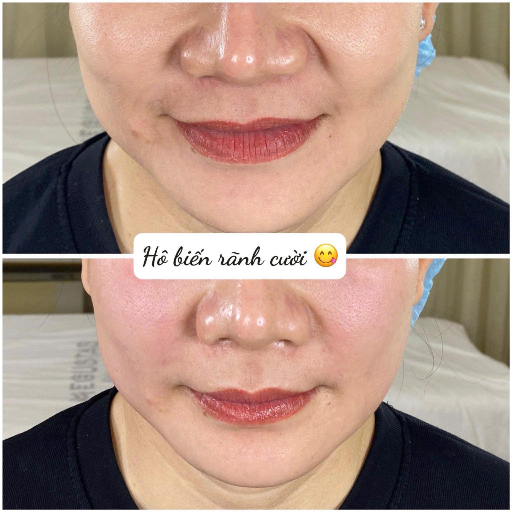 Trang - 😱 𝐂𝐀̀𝐍𝐆 𝐂𝐔̛𝐎̛̀𝐈 𝐂𝐀̀𝐍𝐆 𝐆𝐈𝐀̀ – 𝐓𝐔̛𝐎̛̉𝐍𝐆 𝐕𝐔𝐈 𝐍𝐇𝐔̛𝐍𝐆 𝐓𝐎𝐀𝐍𝐆 𝐋𝐔𝐎̂𝐍 ...