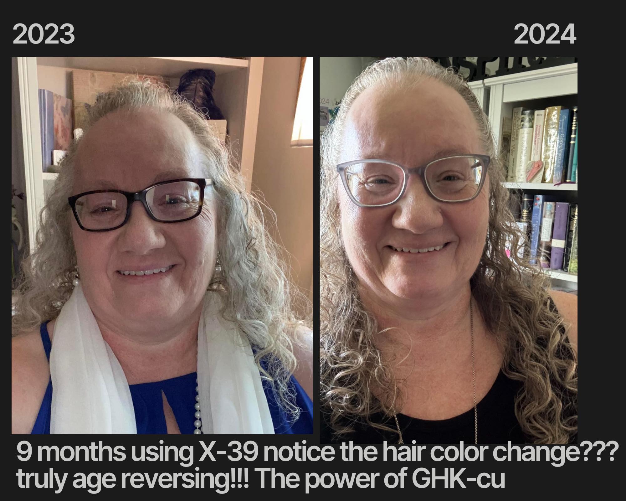 ghk-cu hair repigmentation study So... Just another person reversing in age. The GHK-COPPER Peptide is known, since 1973, to thicken follicles, increase the number of follicles and to reverse the changes in color where hair 5MG peptide