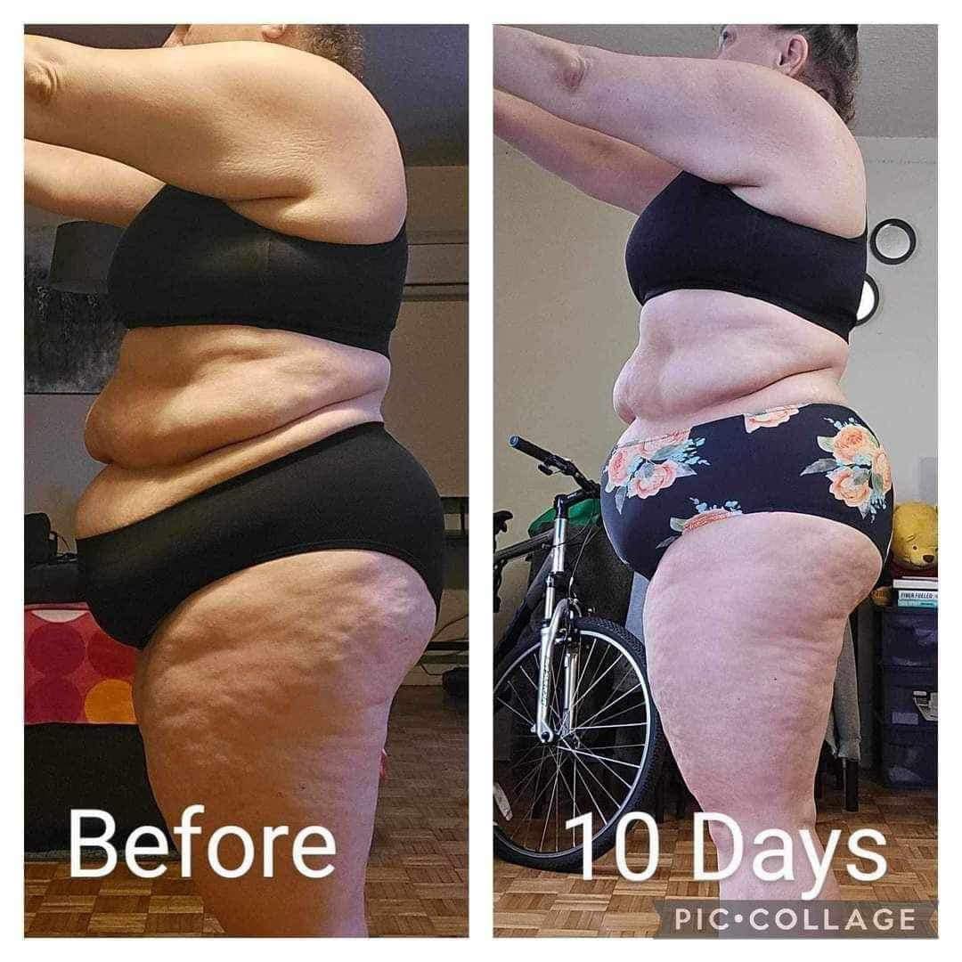 l carnitine results forum Most people in the industry say L-Carnitine tartrate doesn't work but how does it give me energy? Most people report this so something is happening Frontiers | The influence Type_Vitamin B Amount:50MG