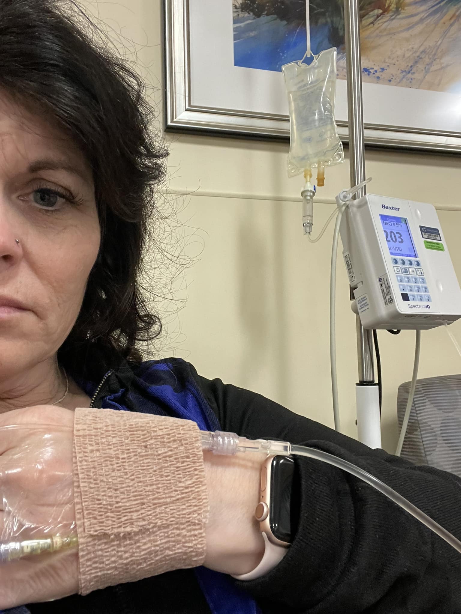 What to expect from iron infusions and b12 shots for rfc?