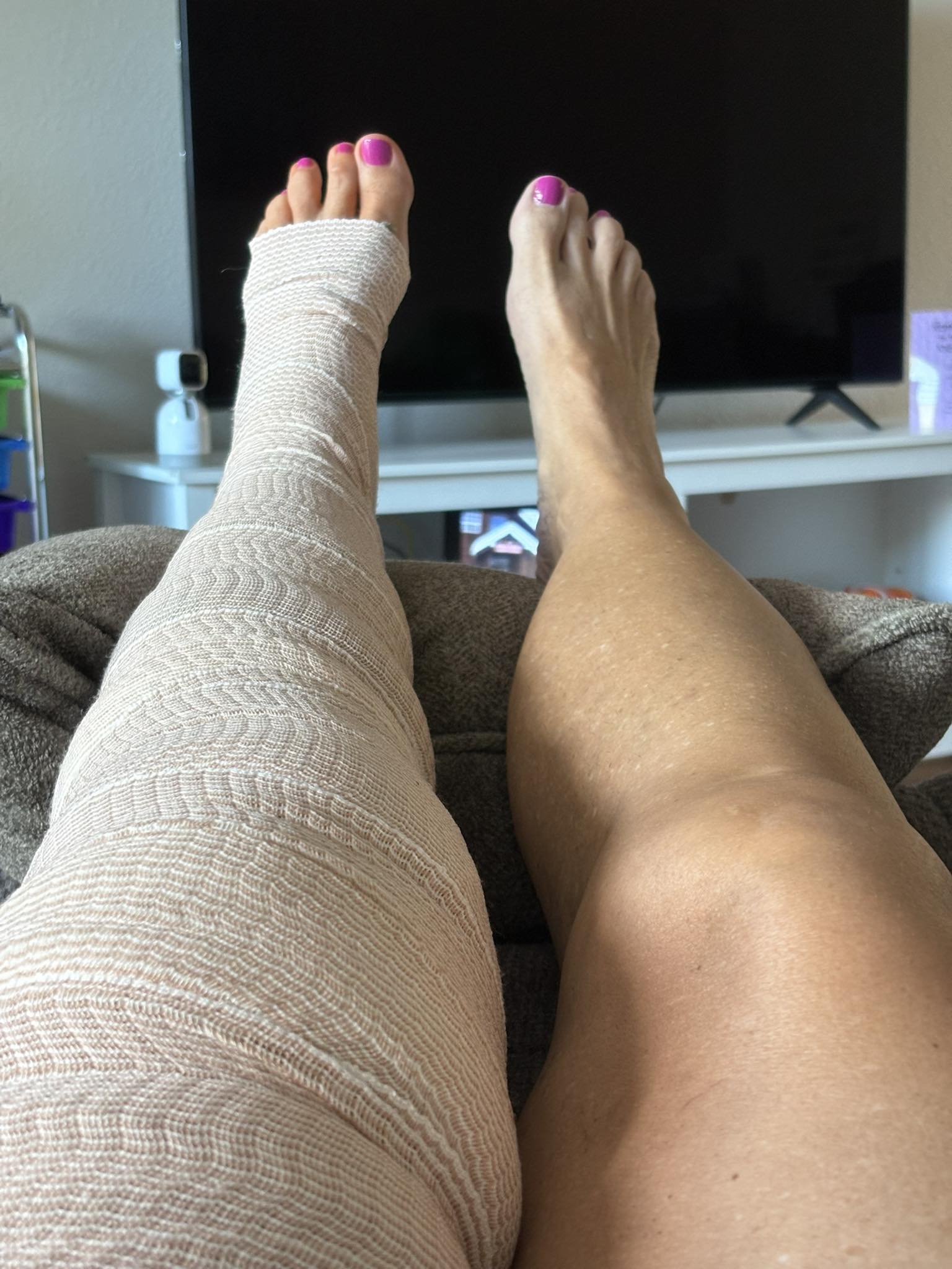 I got my new knee today and I'm back home resting. So far, so good.