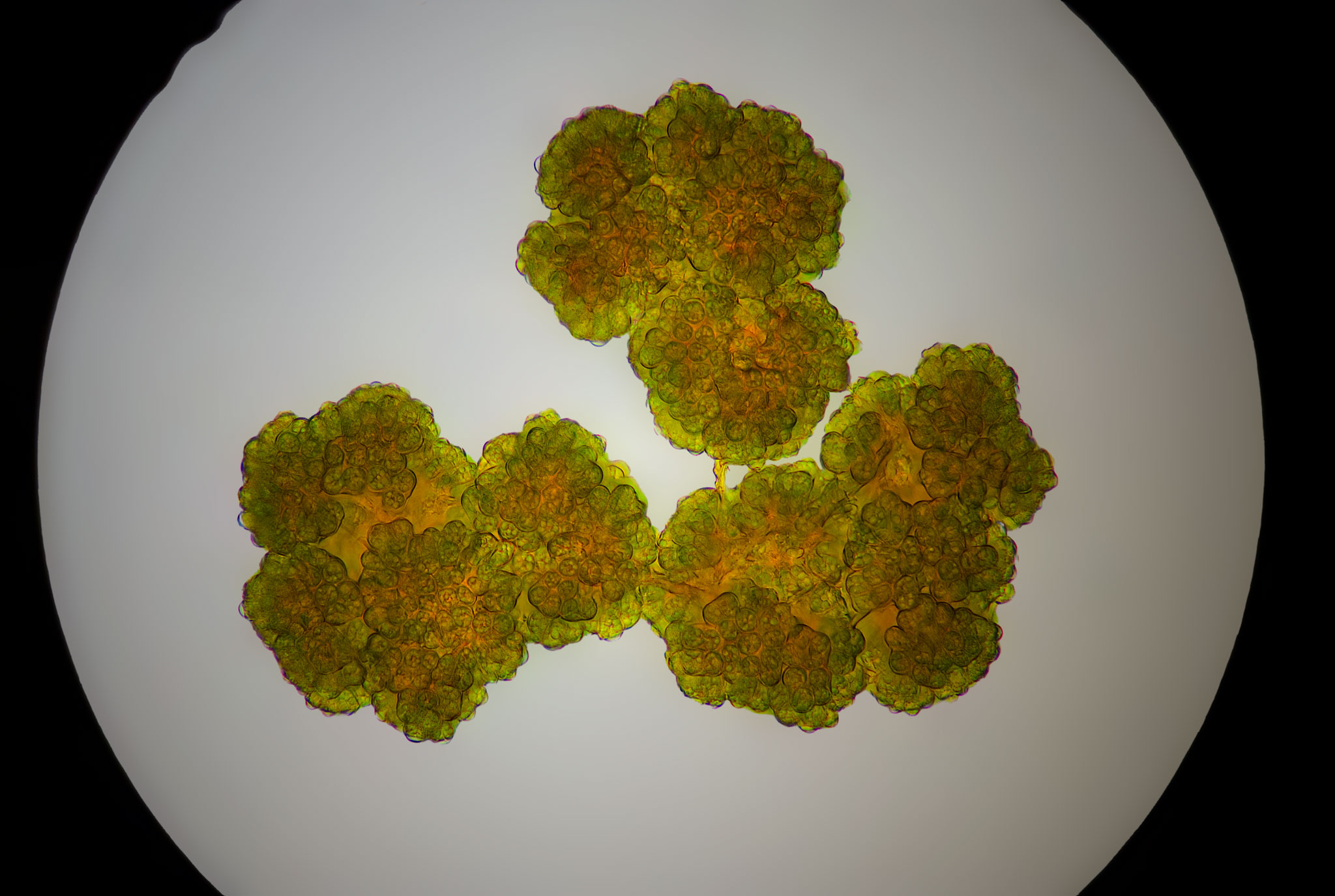 Amateur Microscopy | Botryococcus | Facebook
