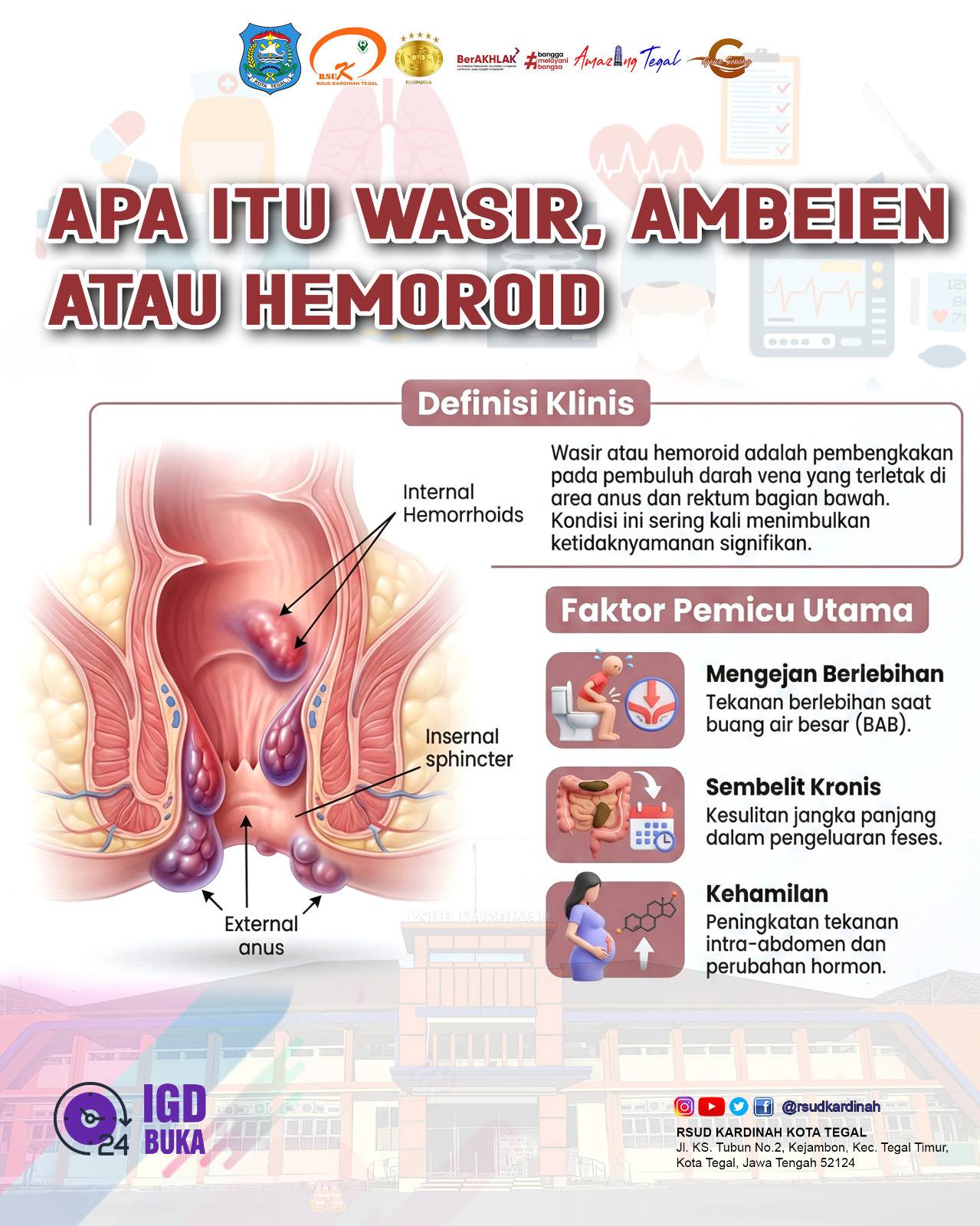 🔎 Kenali Wasir, Ambeien, atau... - Rsu Kardinah Tegal | Facebook
